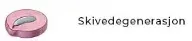 Diagram som viser tverrsnitt av en skive med skivedegenerasjon.